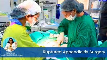 Dr Amita Jain is the best Ruptured Appendicitis Surgeon